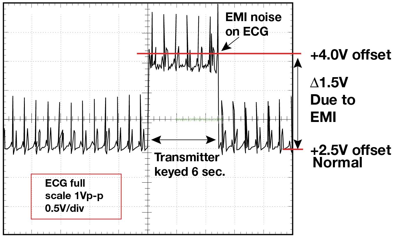 圖 1    1.5 英尺以外的發射器（f = 470 MHz, P= 0.5W）開啟和關閉時 ECG 診斷設備的心臟檢查結果