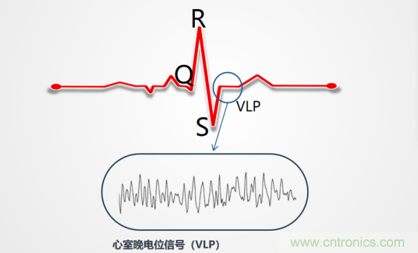 解決心電監測行業難題，曼森伯格的濾波技術獲國家知識產權局發明授權