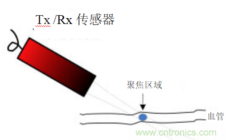 超聲系統的信號鏈設計注意事項