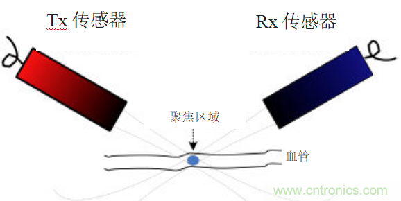 超聲系統的信號鏈設計注意事項